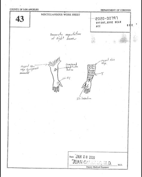 kobe bryant and gigi autopsy|Kobe Bryant Autopsy Report Is Released After。